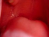 tonsils.jpg image by someblondechick